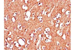 Immunohistochemistry of paraffin-embedded human brain tissue using ABIN7150398 at dilution of 1:100 (IGHMBP2 抗体  (AA 646-884))