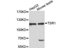 Western blot analysis of extracts of various cell lines, using TSR1 antibody (ABIN6293796) at 1:3000 dilution. (TSR1 抗体)