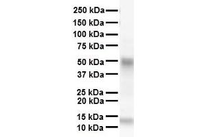 WB Suggested Anti-SMAD6 antibody Titration: 1 ug/mL Sample Type: Human heart (SMAD6 抗体  (N-Term))