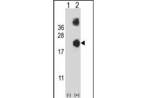 Western blot analysis of DSTN (arrow) using rabbit polyclonal DSTN Antibody (Center) (ABIN653136 and ABIN2842712). (Destrin 抗体  (AA 70-98))