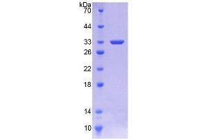 SDS-PAGE (SDS) image for Serpin Family C Member 1 (SERPINC1) (AA 1-259) protein (His tag) (ABIN6238684)