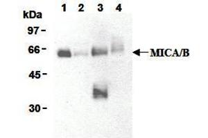 Western Blotting (WB) image for anti-MHC Class I Polypeptide-Related Sequence A (MICA) antibody (ABIN1108244) (MICA 抗体)