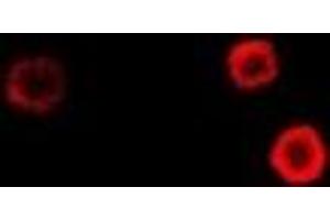 Immunofluorescent analysis of Epsilon-sarcoglycan staining in Hela cells. (SGCE 抗体)