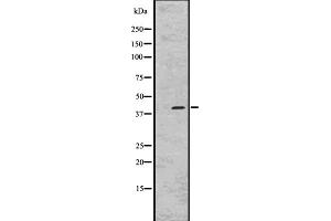 Western blot analysis of GPR45 expression in RPMI-8226 whole cell lysate ;,The lane on the left is treated with the antigen-specific peptide. (GPR45 抗体  (Internal Region))