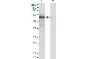 Western Blot analysis of YAP1 expression in transfected 293T cell line by YAP1 monoclonal antibody (M01), clone 2F12.