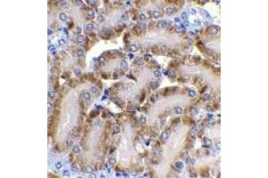 Immunohistochemical staining of CAD in mouse kidney tissue with CAD antibody at 2μg/ml. (DFFB 抗体  (AA 205-222))