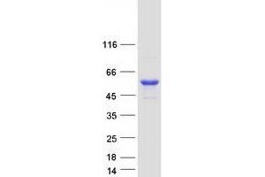 Validation with Western Blot (CYP4F11 Protein (Transcript Variant 1) (Myc-DYKDDDDK Tag))