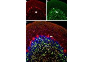 Multiplex staining of CaV1.