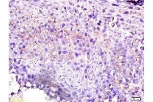 Immunohistochemistry (Paraffin-embedded Sections) (IHC (p)) image for anti-rho/rac Guanine Nucleotide Exchange Factor (GEF) 2 (ARHGEF2) (AA 21-120) antibody (ABIN705161)