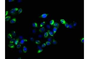 Immunofluorescence staining of Hela cells with ABIN7158282 at 1:100, counter-stained with DAPI. (CD47 抗体  (AA 44-141))