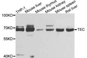 Western blot analysis of extracts of various cell lines, using TEC antibody. (NR4A3 抗体  (AA 1-280))