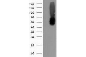 Western Blotting (WB) image for anti-Calcium Binding and Coiled-Coil Domain 2 (CALCOCO2) antibody (ABIN1497075) (CALCOCO2 抗体)