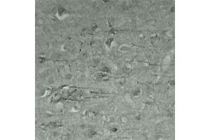 IHC on mouse brain (cryo section) using Rabbit antibody to Synaptotagmin 17  at a concentration of 50 µg/ml incubated overnight at 4C. (SYT17 抗体  (Internal Region))