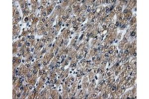 Immunohistochemical staining of paraffin-embedded liver tissue using anti-RALBP1mouse monoclonal antibody. (RALBP1 抗体)