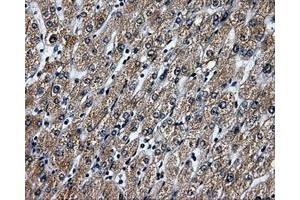 Immunohistochemical staining of paraffin-embedded liver tissue using anti-RALBP1mouse monoclonal antibody. (RALBP1 抗体)