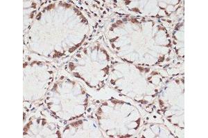 Immunohistochemistry (Paraffin-embedded Sections) (IHC (p)) image for anti-Protein Kinase, AMP-Activated, alpha 1 Catalytic Subunit (PRKAA1) (pThr172), (pThr183) antibody (ABIN7265094)