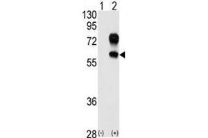 Image no. 1 for anti-Kringle Containing Transmembrane Protein 1 (KREMEN1) (N-Term) antibody (ABIN357077) (KREMEN1 抗体  (N-Term))