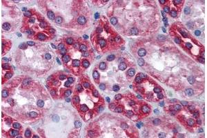 Human Kidney: Formalin-Fixed, Paraffin-Embedded (FFPE) (Calnexin 抗体  (AA 204-218))