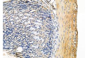 ABIN6263463 and ABIN6278323 at 1/100 staining Mouse stomach tissue by IHC-P. (MYH11 抗体  (C-Term))