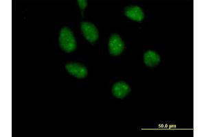 Immunofluorescence of purified MaxPab antibody to GATAD2B on HeLa cell. (GATAD2B 抗体  (AA 1-593))