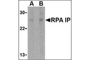 Western blot analysis of RPA Interacting Protein in Jurkat cell lysate with this product at (A) 1 and (B) 2 μg/ml. (RPAIN 抗体  (C-Term))