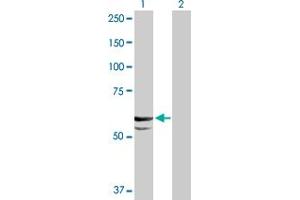 Western Blotting (WB) image for anti-Cytochrome P450, Family 11, Subfamily A, Polypeptide 1 (CYP11A1) (AA 1-521) antibody (ABIN514847)