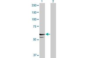 Western Blot analysis of CYP11A1 expression in transfected 293T cell line by CYP11A1 MaxPab polyclonal antibody. (CYP11A1 抗体  (AA 1-521))