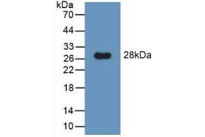 Detection of Recombinant GluAP, Rat using Polyclonal Antibody to Aminopeptidase A (ENPEP) (ENPEP 抗体  (AA 409-624))