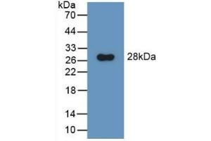 Detection of Recombinant GluAP, Rat using Polyclonal Antibody to Aminopeptidase A (ENPEP)