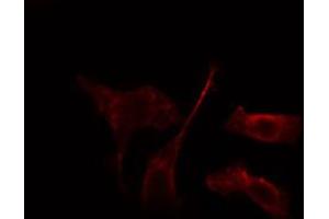 ABIN6274242 staining HepG2 cells by IF/ICC.