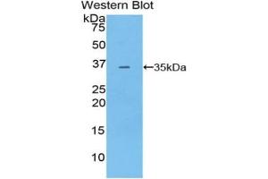 Western blot analysis of the recombinant protein. (PDK4 抗体  (AA 117-387))