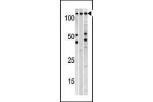 Western blot analysis of anti-CSE1L Pab (ABIN1882070 and ABIN2838356) in, from left to right, , CEM, and mouse heart cell line lysates (35 μg/lane). (CSE1L 抗体  (N-Term))