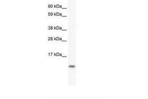 Image no. 1 for anti-FXYD Domain Containing Ion Transport Regulator 5 (FXYD5) (AA 54-103) antibody (ABIN307427) (FXYD5 抗体  (AA 54-103))