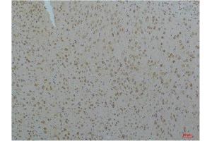 Immunohistochemistry (IHC) analysis of paraffin-embedded Mouse Brain Tissue using Cav pan alpha1 Rabbit Polyclonal Antibody diluted at 1:200. (Cav Pan Alpha1 (pan) 抗体)