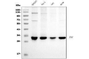 Western blot analysis of PNP using anti-PNP antibody (ABIN7602997).