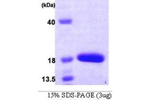 SDS-PAGE (SDS) image for Chromosome 19 Open Reading Frame 10 (C19orf10) (AA 33-173) protein (His tag) (ABIN666880) (C19orf10 Protein (AA 33-173) (His tag))
