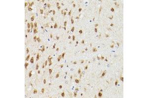 Immunohistochemistry of paraffin-embedded rat brain using PSM Rabbit pAb (ABIN3021834, ABIN3021835, ABIN3021836 and ABIN6216081) at dilution of 1:100 (40x lens). (PSMA3 抗体  (AA 1-255))