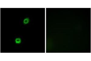 Immunofluorescence (IF) image for anti-Myristoylated Alanine-Rich Protein Kinase C Substrate (MARCKS) (AA 126-175) antibody (ABIN2889023) (MARCKS 抗体  (AA 126-175))