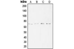 Western blot analysis of SYT16 expression in A431 (A), HeLa (B), A2058 (C), Jurkat (D) whole cell lysates. (SYT16 抗体  (Center))