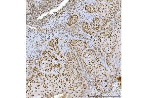 IHC analysis of RCC1 using anti-RCC1 antibody (ABIN7600022). (RCC1 抗体  (AA 14-421))