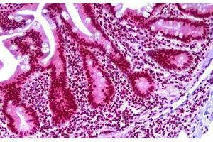 Anti-TARBP2 antibody IHC staining of human small intestine. (TARBP2 抗体)