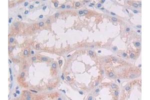 Detection of HLA-DRB1 in Human Kidney Tissue using Polyclonal Antibody to HLA Class II Histocompatibility Antigen, DRB1 Beta Chain (HLA-DRB1)
