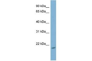 WB Suggested Anti-NME4 Antibody Titration: 0. (NME4 抗体  (Middle Region))