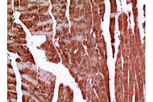Immunohistochemistry (IHC) image for anti-Amphiphysin (AMPH) (C-Term) antibody (ABIN3187832)