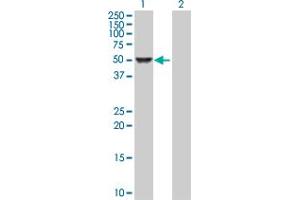 Western Blot analysis of CAMK4 expression in transfected 293T cell line by CAMK4 MaxPab polyclonal antibody. (CAMK4 抗体  (AA 1-473))