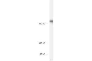 dilution: 1 : 1000, sample: rat hippocampus homogenate (CACNA1B 抗体  (alpha-1E subunit))