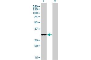 Western Blotting (WB) image for anti-CoA Synthase (COASY) (AA 1-225) antibody (ABIN566448)