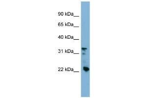 WB Suggested Anti-CRYBB3 Antibody Titration: 0. (CRYBB3 抗体  (Middle Region))