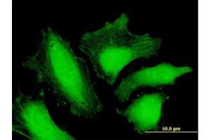 Immunofluorescence of purified MaxPab antibody to MTMR15 on HeLa cell. (FAN1 抗体  (AA 1-533))