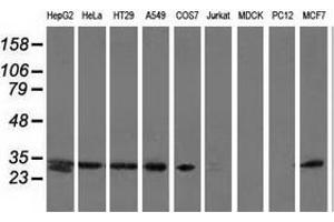 Western blot analysis of extracts (35 µg) from 9 different cell lines by using anti-SPR monoclonal antibody. (SPR 抗体)